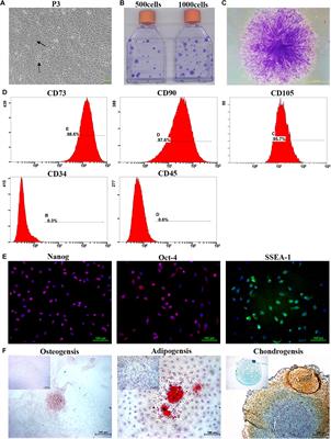 Enhancement of Migration and Tenogenic Differentiation of Macaca Mulatta Tendon-Derived Stem Cells by Decellularized Tendon Hydrogel